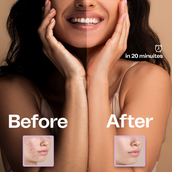 Jelly Tan Vanish Gluta-Kojic Skin Polish - Image 8